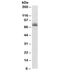 Western blot testing of human colon lysate with SERT antibody at 2ug/ml. Expected molecular weight: