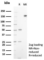SDS-PAGE analysis of purified, BSA-free CD23 antibody (clone FCER2/8236R) as confirmation of integri
