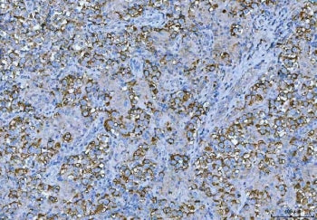 FMRP Antibody / FMR1