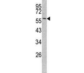Keratin-14 Antibody