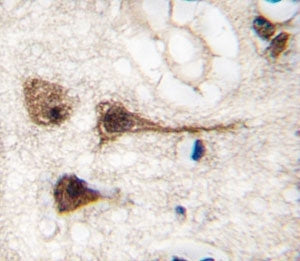 MEF2C Antibody