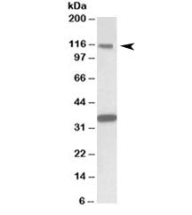 KIT Antibody