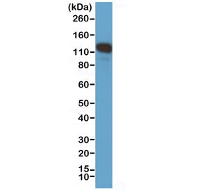 CD146 Antibody