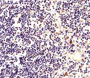 Nucleophosmin Antibody (Npm1)