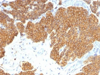 Parathyroid Hormone Antibody / N Terminal