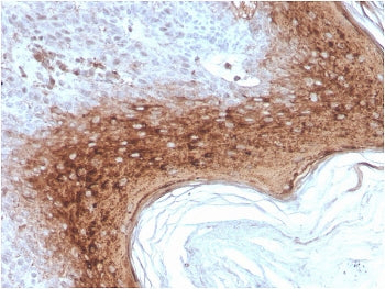 IHC staining of FFPE human skin with recombinant Involucrin antibody (clone rIVRN/827J). HIER: boil
