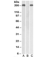 Thrombospondin Antibody