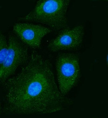 Pyruvate Kinase Antibody / PKM2