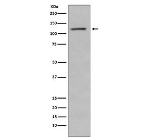 Western blot testing of lysate from human Jurkat cells treated with Alkaline Phosphatase, with Retin