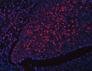 RFX1 Antibody / Regulatory factor X 1