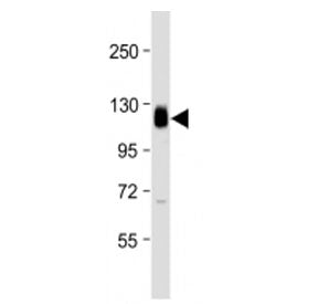 Thrombomodulin Antibody (N-Terminal Region)