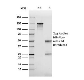 FABP2 Antibody (intestinal)