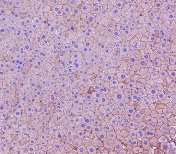 IHC staining of FFPE mouse liver tissue with CK18 antibody. HIER: boil tissue sections in pH6, 10mM