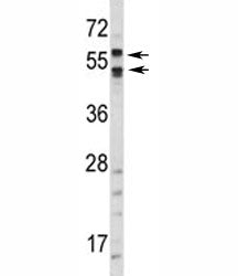 CA9 Antibody