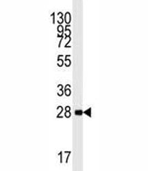 AMPK beta 1 Antibody / PRKAB1, 0.4ml