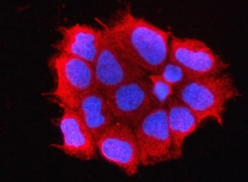 Immunofluorescent staining of FFPE human Caco-2 cells with OMP antibody (red) and DAPI nuclear stain