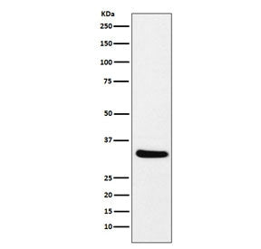 CRALBP Antibody / RLBP1
