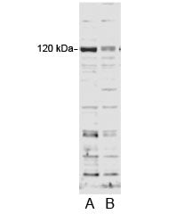 SECISBP2 Antibody