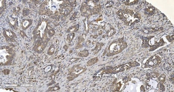 ARG2 Antibody / Arginase 2