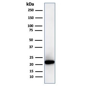 Western blot testing of human kidney lysate with recombinant Ferritin Light Chain antibody (clone FT