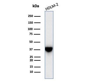 Western blot testing of human HDLM-2 cell lysate with STING antibody (clone STING1/7438). Predicted