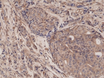 p65 Antibody / NF-kB