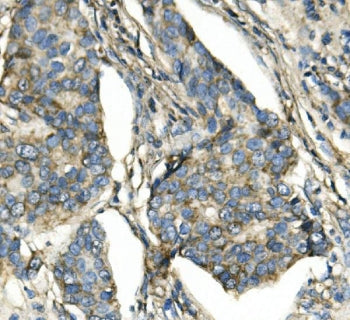 ATP5H Antibody