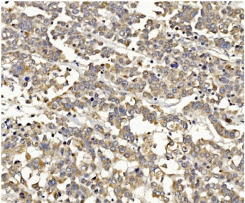 PI3K gamma Antibody / PIK3CG