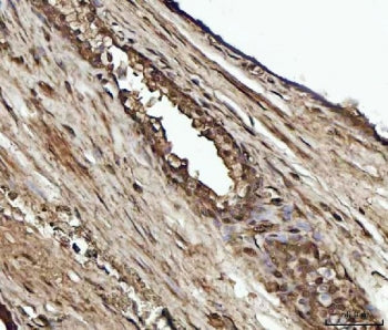 YWHAE Antibody / 14-3-3 epsilon