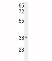 IGFBP3 Antibody