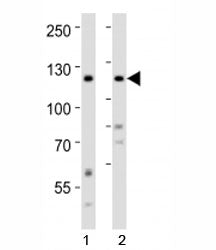 Western blot analysis of lysate from 1) human HeLa and 2) human SH-SY5Y cell line using Ror2 antibod