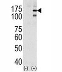 EGFR Antibody (phospho-Y1069)