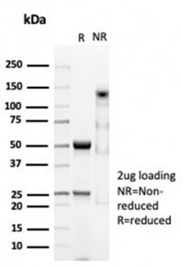 SDS-PAGE analysis of purified, BSA-free CD74 antibody (clone CLIP/7023R) as confirmation of integrit