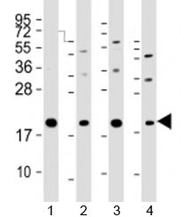 APC11 Antibody / ANAPC11