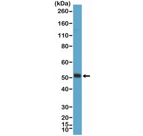 Myogenin D1 Antibody / MyoD1