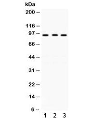 Western blot testing of human 1) A431, 2) 22RV1 and 3) COLO320 lysate with GCN5 antibody. Expected/o