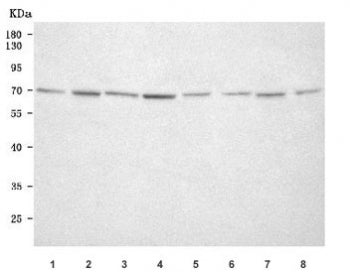 Mu-type Opioid Receptor Antibody / OPRM1