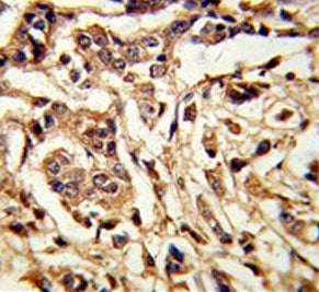 Galactose-1-phosphate uridylyltransferase Antibody / GALT