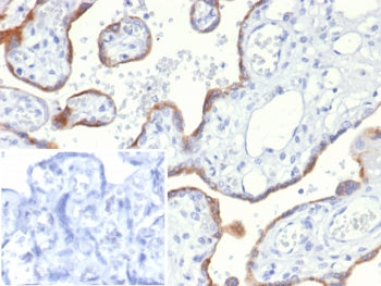 S100A2 Antibody