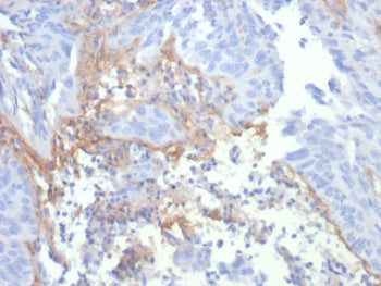 Tenascin C Antibody