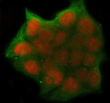 UHRF1 Antibody