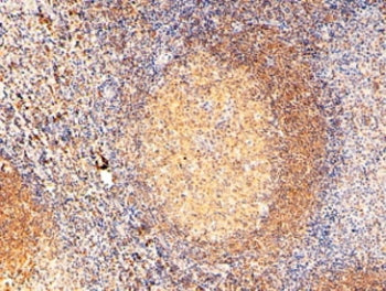IHC staining of FFPE human tonsil tissue with RAC2 antibody at 2ug/ml. Required HIER: steamed antige