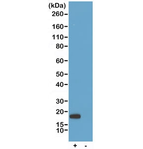 His Tag Chimeric Human Antibody