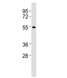 CB1 Antibody