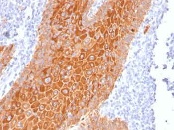 Pan Cytokeratin Antibody Cocktail (Acidic + Basic)
