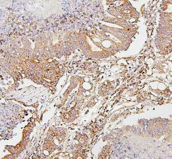 SDHB Antibody