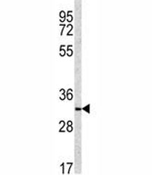 NQO1 Antibody