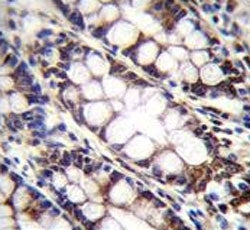 UQCRFS1 Antibody