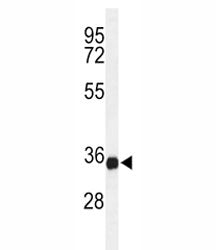 Western blot analysis of lysate from U-937 cell line using STING antibody at 1:1000. Predicted molec