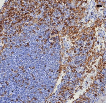 IHC staining of FFPE human tonsil tissue with recombinant CD4 antibody (clone CD4/8203R) at 2ug/ml.